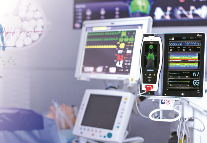 How to Choose the Right Patient Monitoring System for Hospitals