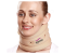 Tynor B-07 Soft Cervical Collar