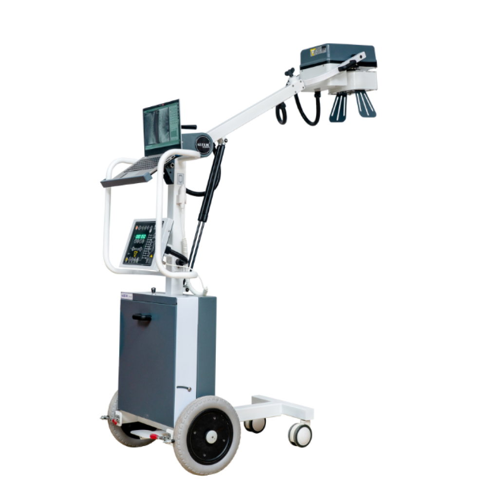 Alerio Smart 5000 DX Digital Mobile X-Ray