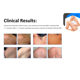 Healthoware 1200W Diode Laser